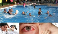 Nguy cơ mắc các bệnh về mắt nếu không sử dụng kính bơi